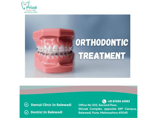 Braces or Aligners: How We Decide What's Right for You