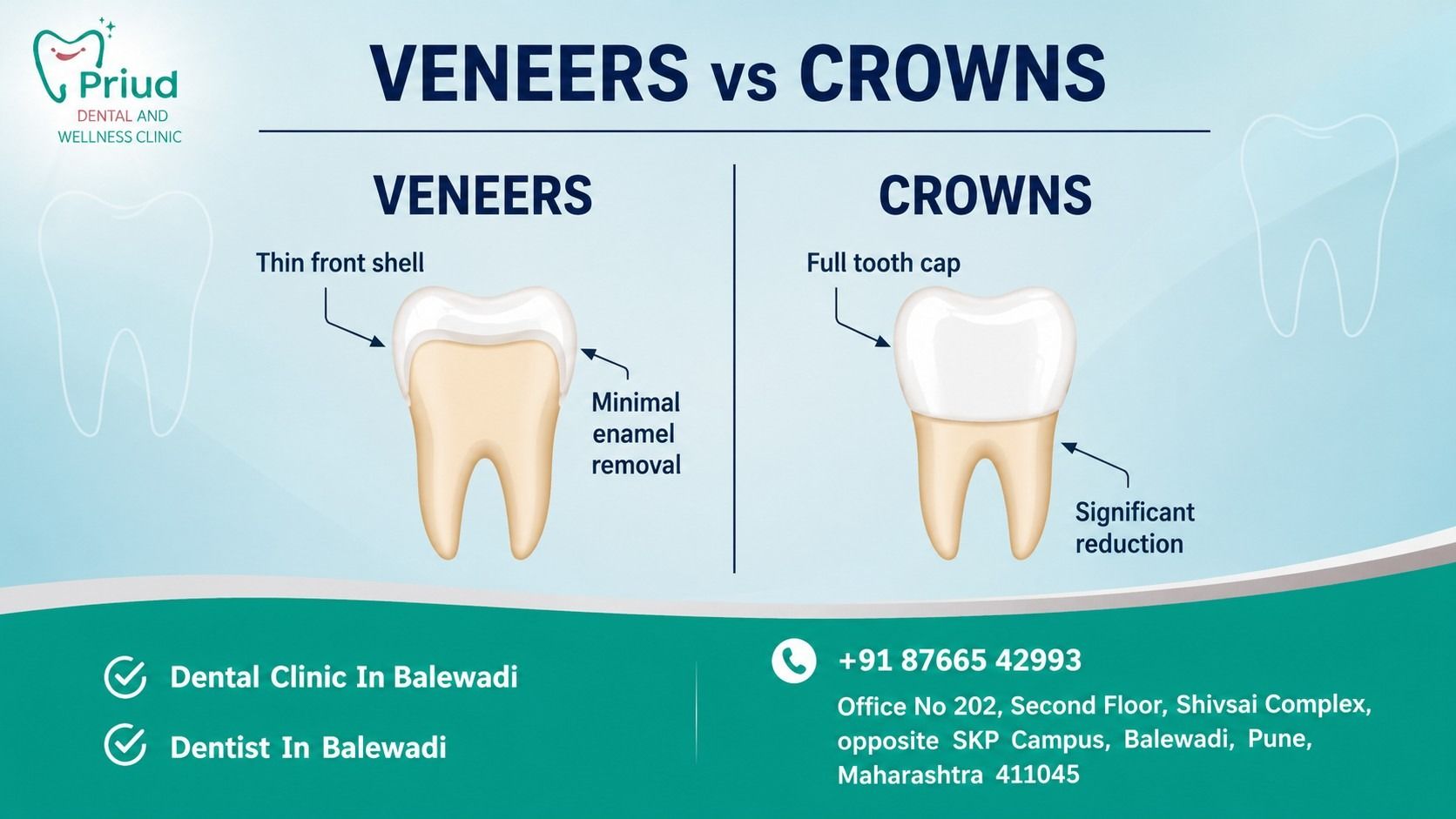 Veneers or Crowns? Here's How We Choose